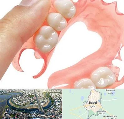 پروتز متحرک دندان در بابل