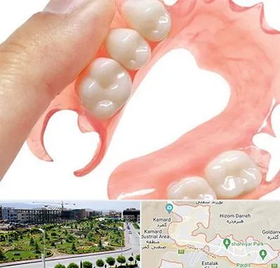 پروتز متحرک دندان در پردیس