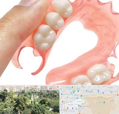 پروتز متحرک دندان در منطقه 13 تهران 