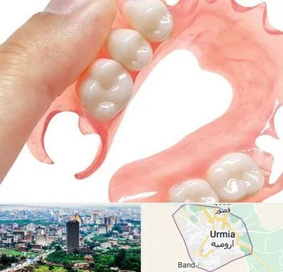 پروتز متحرک دندان در ارومیه
