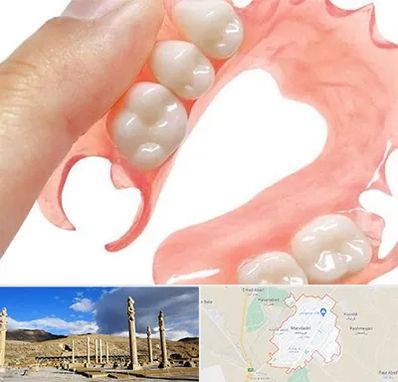 پروتز متحرک دندان در مرودشت