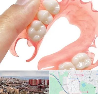 پروتز متحرک دندان در سهند تبریز