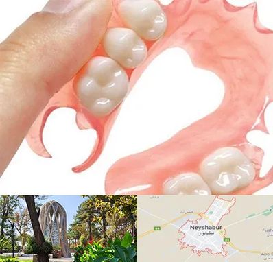 پروتز متحرک دندان در نیشابور