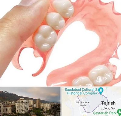 پروتز متحرک دندان در زعفرانیه 