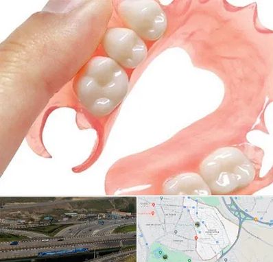 پروتز متحرک دندان در یاغچیان تبریز