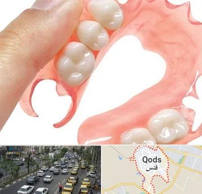 پروتز متحرک دندان در شهر قدس