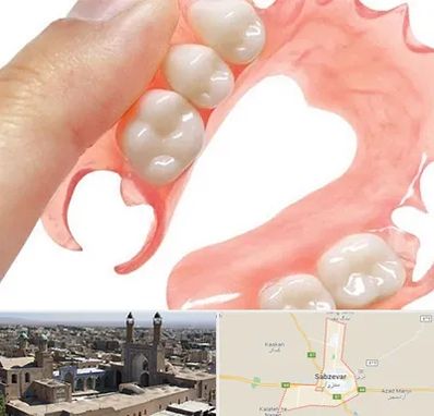پروتز متحرک دندان در سبزوار