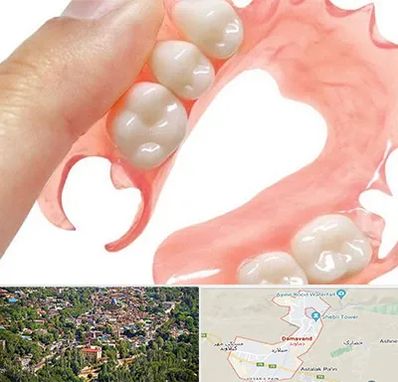 پروتز متحرک دندان در دماوند