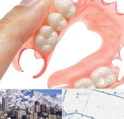 پروتز متحرک دندان در ازگل