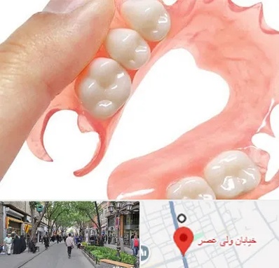 پروتز متحرک دندان در ولیعصر شهریار