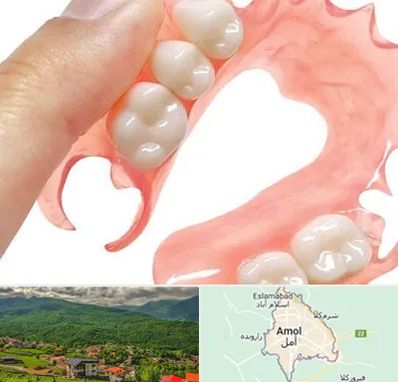 پروتز متحرک دندان در آمل