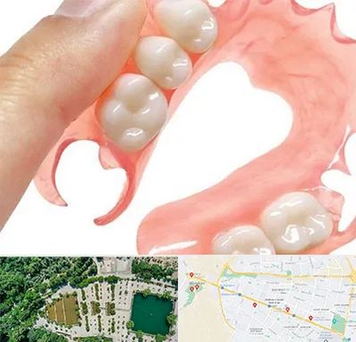 پروتز متحرک دندان در وکیل آباد مشهد 