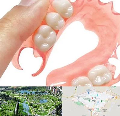 پروتز متحرک دندان در بجنورد