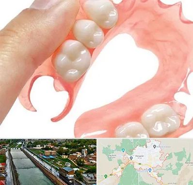 پروتز متحرک دندان در مراغه