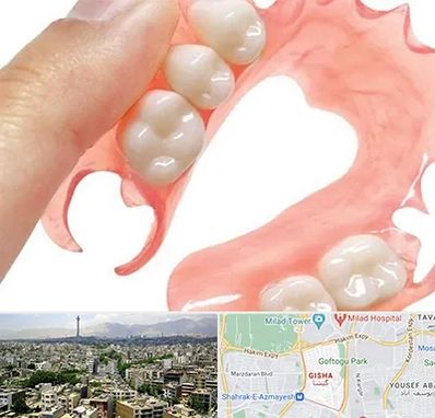 پروتز متحرک دندان در گیشا 