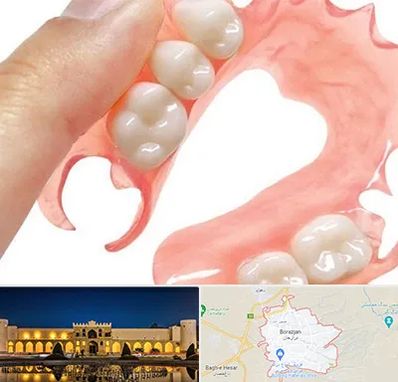 پروتز متحرک دندان در برازجان