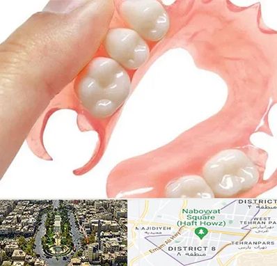 پروتز متحرک دندان در نارمک 