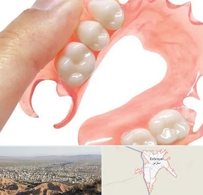 پروتز متحرک دندان در اسفراین