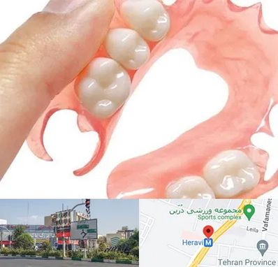 پروتز متحرک دندان در هروی 
