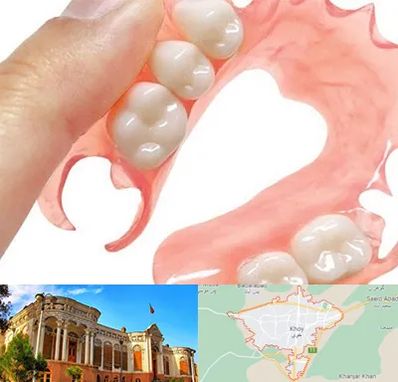 پروتز متحرک دندان در خوی