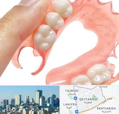 پروتز متحرک دندان در قیطریه 
