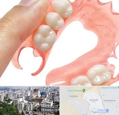 پروتز متحرک دندان در ولنجک 