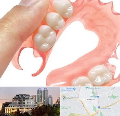 پروتز متحرک دندان در فرشته 