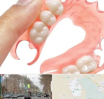 پروتز متحرک دندان در نظرآباد کرج 