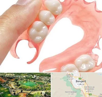 پروتز متحرک دندان در بروجرد