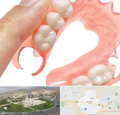 پروتز متحرک دندان در بومهن