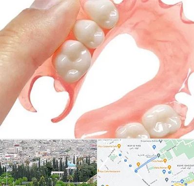 پروتز متحرک دندان در محلاتی شیراز 