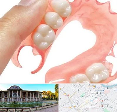 پروتز متحرک دندان در عفیف آباد شیراز 