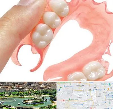 پروتز متحرک دندان در منطقه 9 تهران 