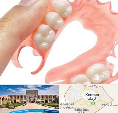 پروتز متحرک دندان در کرمان