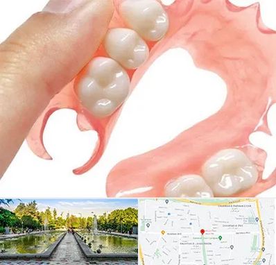 پروتز متحرک دندان در سرسبز 