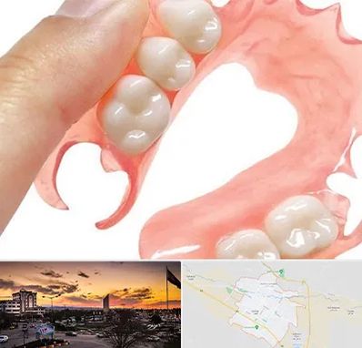 پروتز متحرک دندان در قوچان