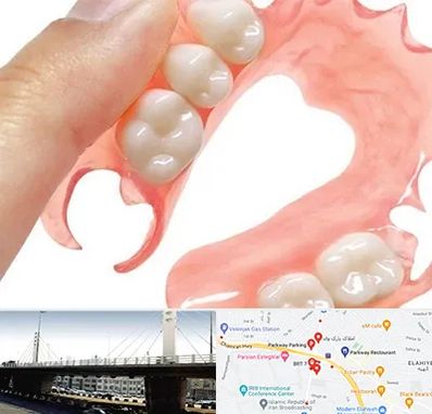پروتز متحرک دندان در پارک وی 