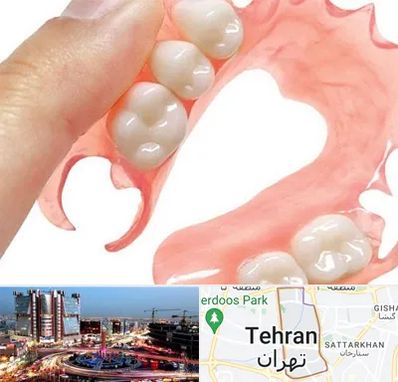 پروتز متحرک دندان در صادقیه 