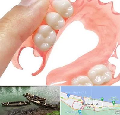 پروتز متحرک دندان در بندر انزلی