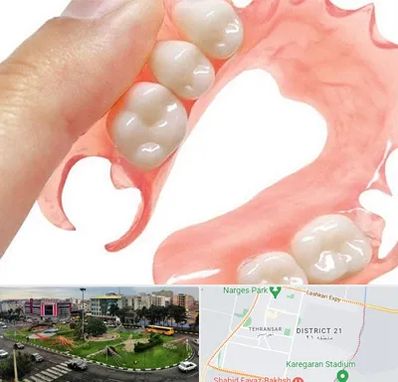 پروتز متحرک دندان در تهرانسر 
