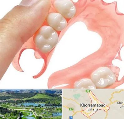 پروتز متحرک دندان در خرم آباد