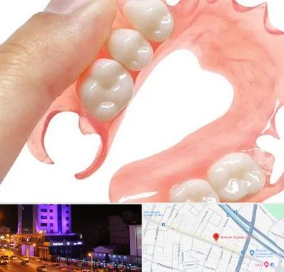 پروتز متحرک دندان در آبرسان تبریز