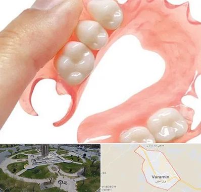 پروتز متحرک دندان در ورامین