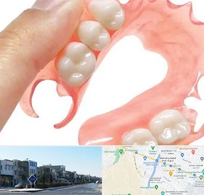 پروتز متحرک دندان در شریعتی مشهد 