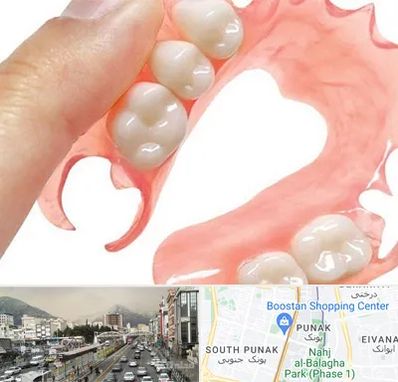 پروتز متحرک دندان در پونک 