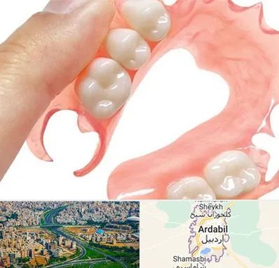 پروتز متحرک دندان در اردبیل