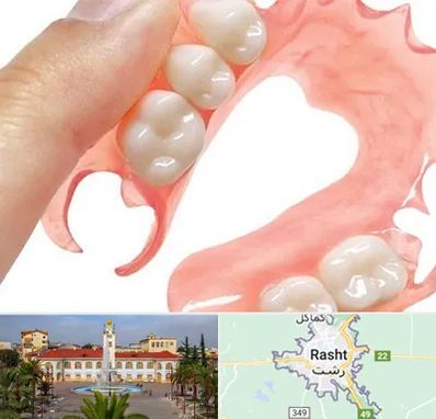 پروتز متحرک دندان در رشت