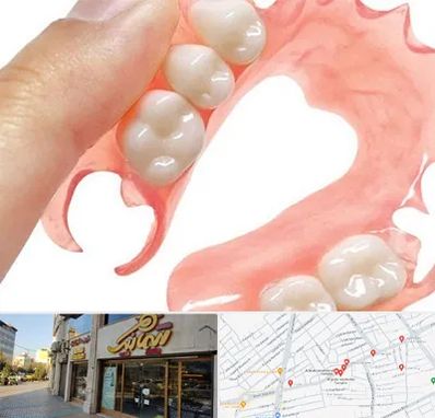 پروتز متحرک دندان در عطاران قم