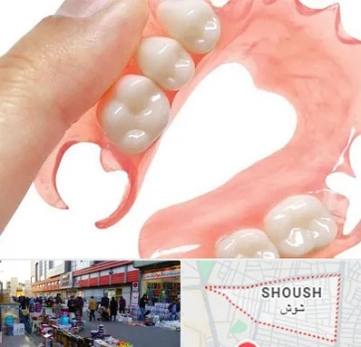 پروتز متحرک دندان در شوش