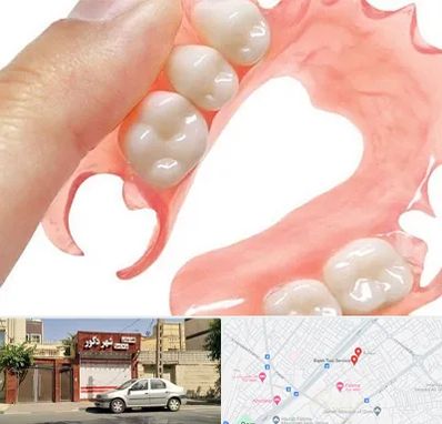 پروتز متحرک دندان در باجک قم